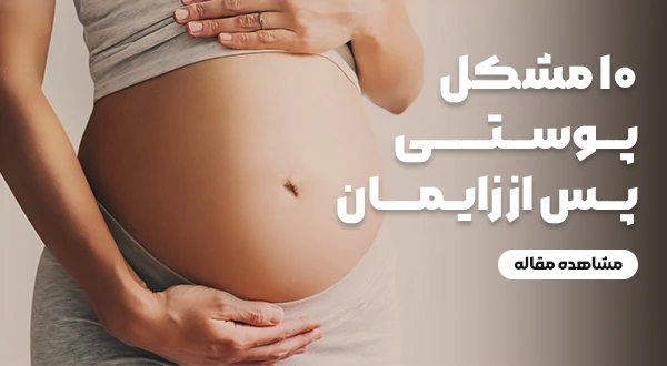 10 مشکل پوستی پس از زایمان