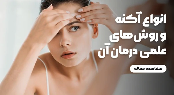 انواع آکنه و روش‌های علمی درمان آن