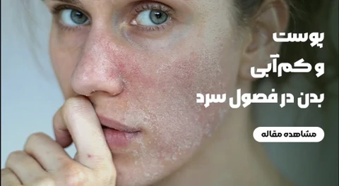 پوست و کم‌آبی بدن در فصول سرد: چرا با وجود هوای خنک‌تر باز هم پوست دهیدراته می‌شود و چه باید کرد؟