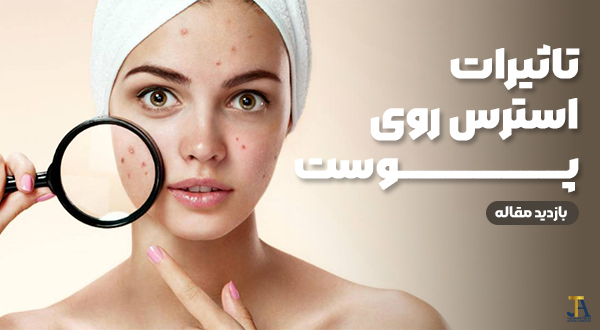 تأثیر استرس بر پوست: چگونه اضطراب زیبایی پوست شما را تهدید می‌کند؟